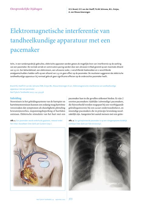 electrical transformer box and pacemaker interference|does electronics interfere with pacemakers.